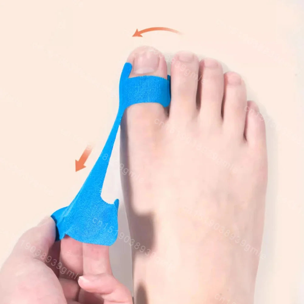 Elastic Bunion Corrector Set